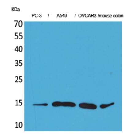 Western blot - Eotaxin-3 Polyclonal Antibody from Signalway Antibody (41565) - Antibodies.com
