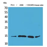 Western blot - Eotaxin-3 Polyclonal Antibody from Signalway Antibody (41565) - Antibodies.com