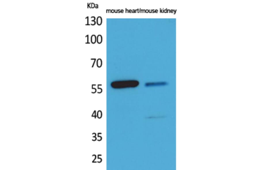 Western blot - Angptl1/2 Polyclonal Antibody from Signalway Antibody (41596) - Antibodies.com