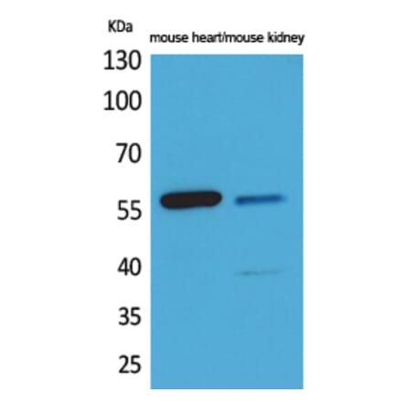 Western blot - Angptl1/2 Polyclonal Antibody from Signalway Antibody (41596) - Antibodies.com