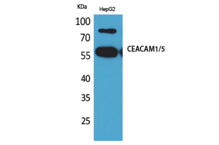 Western blot - CEACAM1/5 Polyclonal Antibody from Signalway Antibody (41614) - Antibodies.com