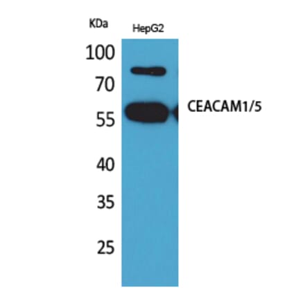 Western blot - CEACAM1/5 Polyclonal Antibody from Signalway Antibody (41614) - Antibodies.com