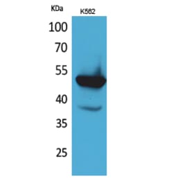 Western blot - Protein C Polyclonal Antibody from Signalway Antibody (41629) - Antibodies.com