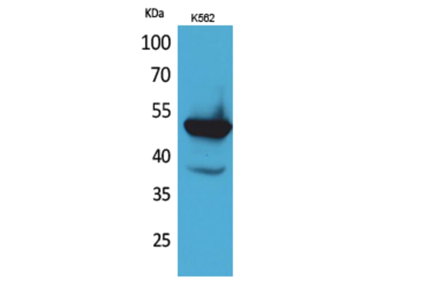 Western blot - Protein C Polyclonal Antibody from Signalway Antibody (41629) - Antibodies.com