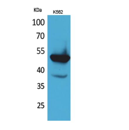 Western blot - Protein C Polyclonal Antibody from Signalway Antibody (41629) - Antibodies.com