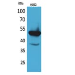 Western blot - Protein C Polyclonal Antibody from Signalway Antibody (41629) - Antibodies.com