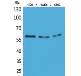 Western blot - CYP11B1/2 Polyclonal Antibody from Signalway Antibody (41632) - Antibodies.com