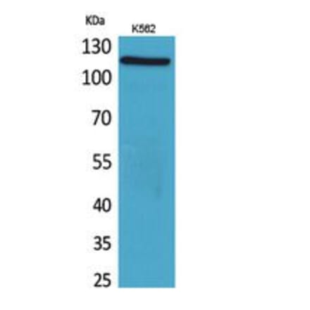 Western blot - Cryopyrin Polyclonal Antibody from Signalway Antibody (41768) - Antibodies.com