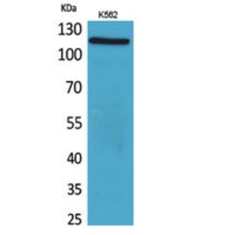 Western blot - Cryopyrin Polyclonal Antibody from Signalway Antibody (41768) - Antibodies.com