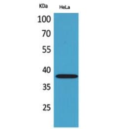 Western blot - CD158b2/j Polyclonal Antibody from Signalway Antibody (41792) - Antibodies.com