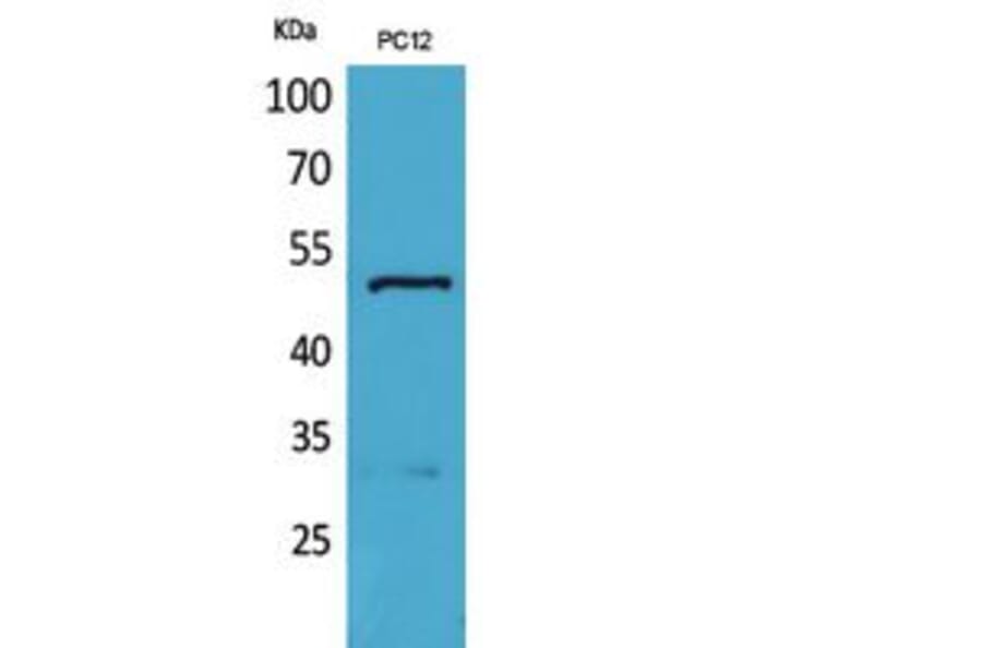 Western blot - Tubulin α Polyclonal Antibody from Signalway Antibody (41810) - Antibodies.com