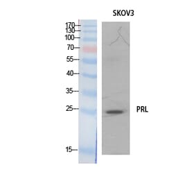 Western blot - Prolactin Polyclonal Antibody from Signalway Antibody (41894) - Antibodies.com