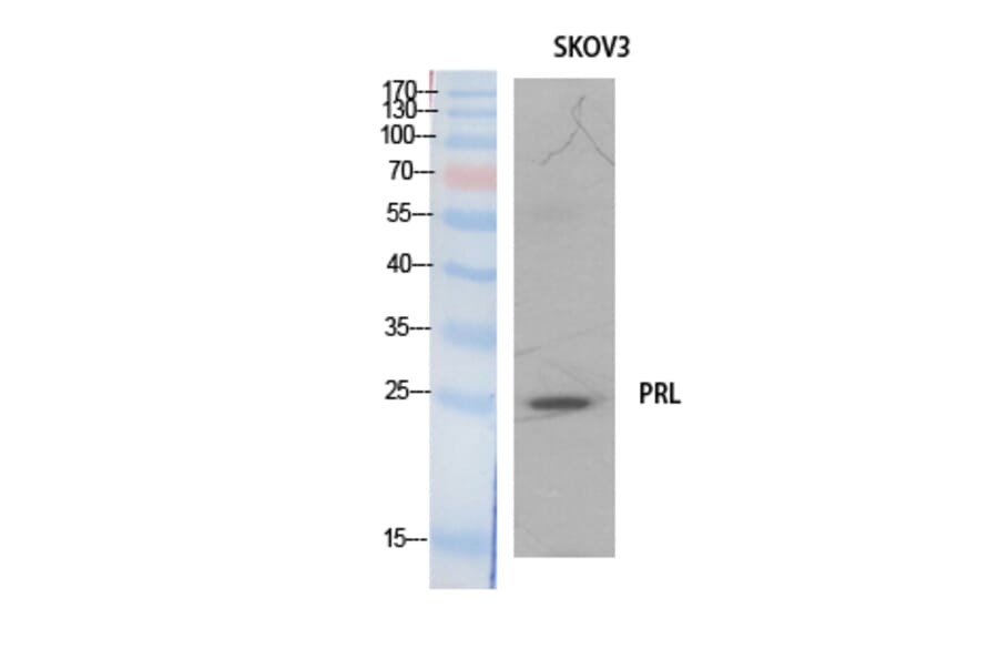 Western blot - Prolactin Polyclonal Antibody from Signalway Antibody (41894) - Antibodies.com