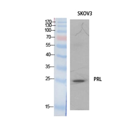Western blot - Prolactin Polyclonal Antibody from Signalway Antibody (41894) - Antibodies.com