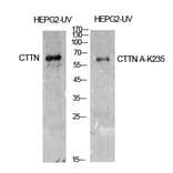 Western blot - Cortactin Polyclonal Antibody from Signalway Antibody (41905) - Antibodies.com