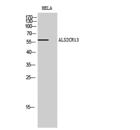 Western blot - ALS2CR13 Polyclonal Antibody from Signalway Antibody (40584) - Antibodies.com