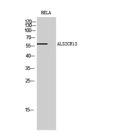 Western blot - ALS2CR13 Polyclonal Antibody from Signalway Antibody (40584) - Antibodies.com