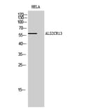 Western blot - ALS2CR13 Polyclonal Antibody from Signalway Antibody (40584) - Antibodies.com