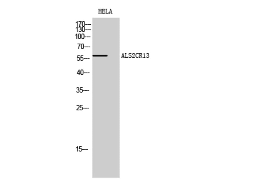 Western blot - ALS2CR13 Polyclonal Antibody from Signalway Antibody (40584) - Antibodies.com