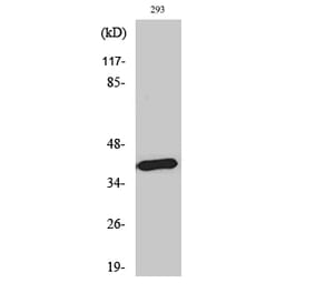Western blot - MEL-1B-R Polyclonal Antibody from Signalway Antibody (41139) - Antibodies.com