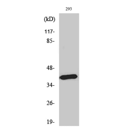 Western blot - MEL-1B-R Polyclonal Antibody from Signalway Antibody (41139) - Antibodies.com