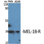 Western blot - MEL-1B-R Polyclonal Antibody from Signalway Antibody (41139) - Antibodies.com