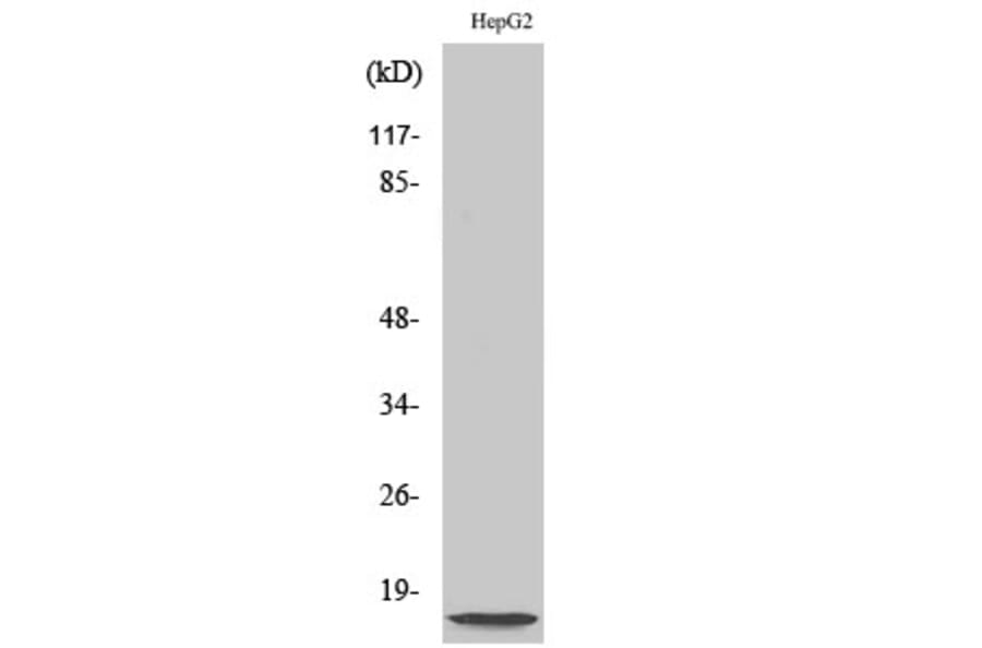 Western blot - NDUFA4L2 Polyclonal Antibody from Signalway Antibody (41206) - Antibodies.com