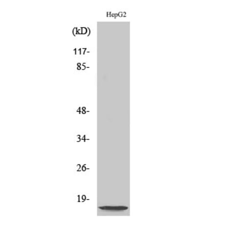 Western blot - NDUFA4L2 Polyclonal Antibody from Signalway Antibody (41206) - Antibodies.com