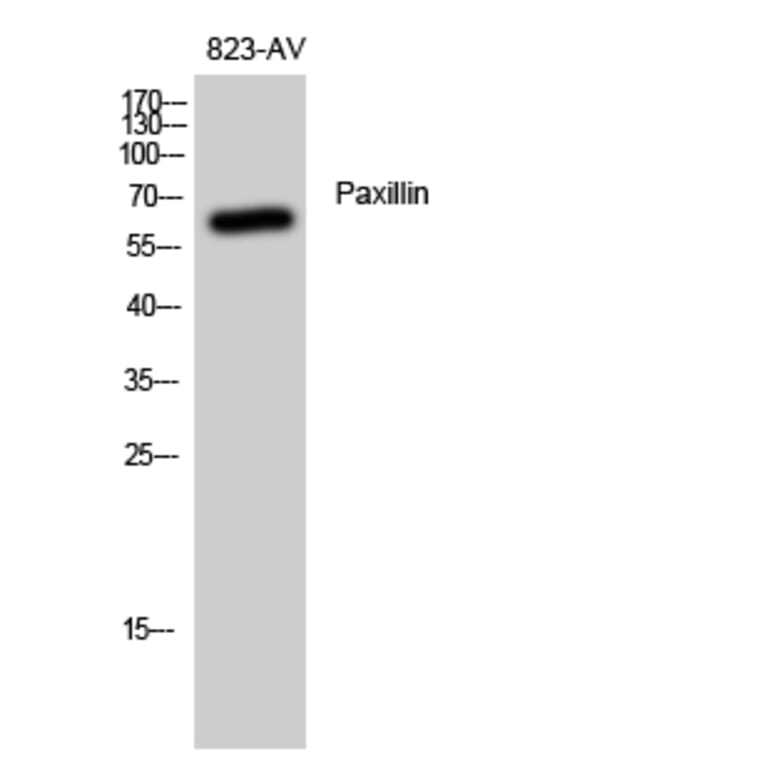 Western blot - Paxillin Polyclonal Antibody from Signalway Antibody (41324) - Antibodies.com