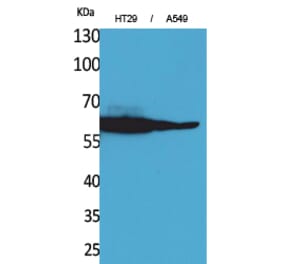 Western blot - Catalase Polyclonal Antibody from Signalway Antibody (41568) - Antibodies.com