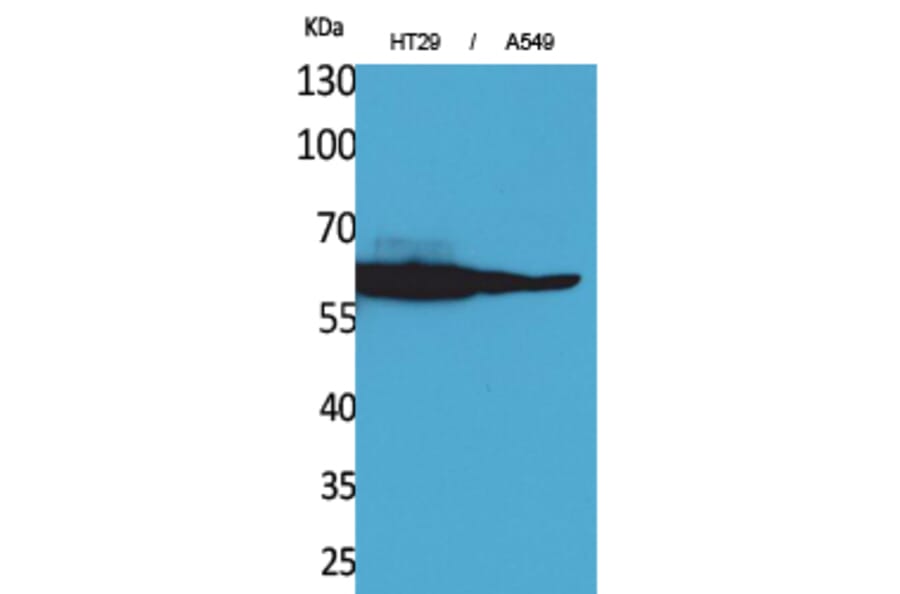 Western blot - Catalase Polyclonal Antibody from Signalway Antibody (41568) - Antibodies.com