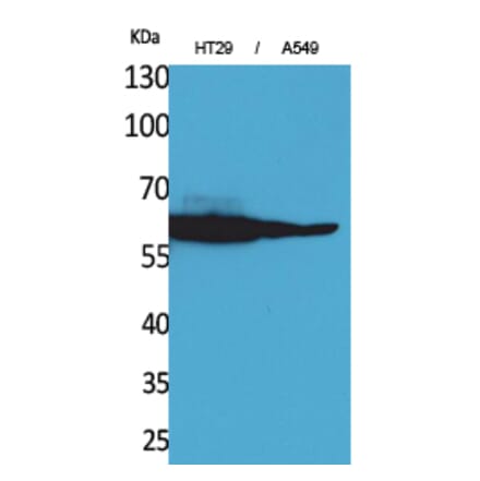 Western blot - Catalase Polyclonal Antibody from Signalway Antibody (41568) - Antibodies.com