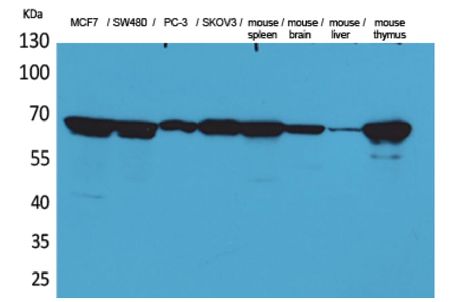 Western blot - Lamin B1 Polyclonal Antibody from Signalway Antibody (41589) - Antibodies.com