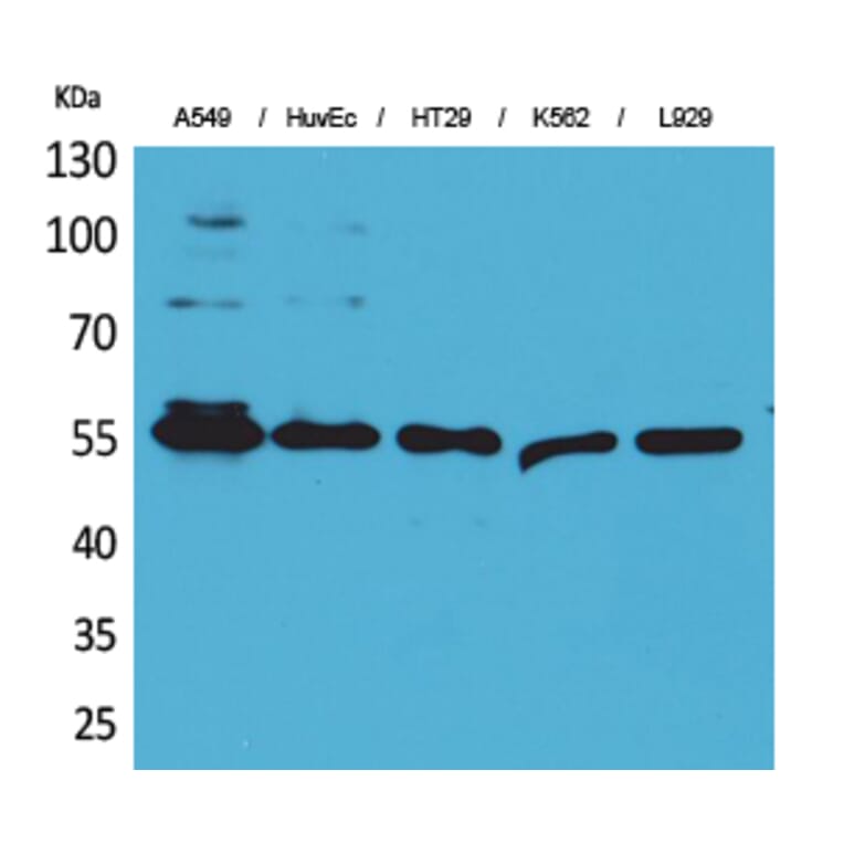 Western blot - Fascin 1 Polyclonal Antibody from Signalway Antibody (41620) - Antibodies.com