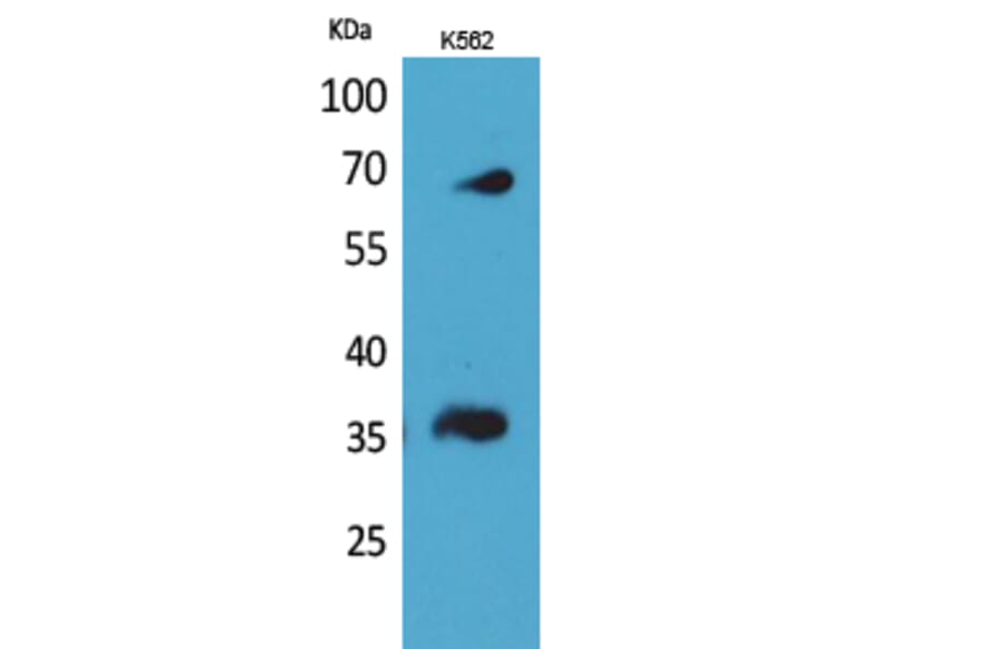 Western blot - CD32-B/C Polyclonal Antibody from Signalway Antibody (41653) - Antibodies.com