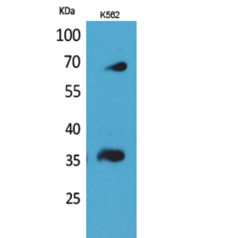 Western blot - CD32-B/C Polyclonal Antibody from Signalway Antibody (41653) - Antibodies.com