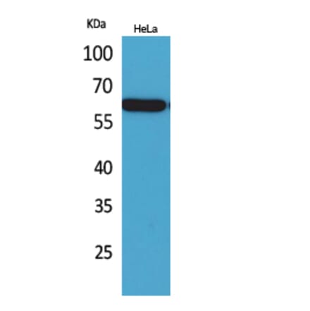 Western blot - Nectin 3 Polyclonal Antibody from Signalway Antibody (41668) - Antibodies.com