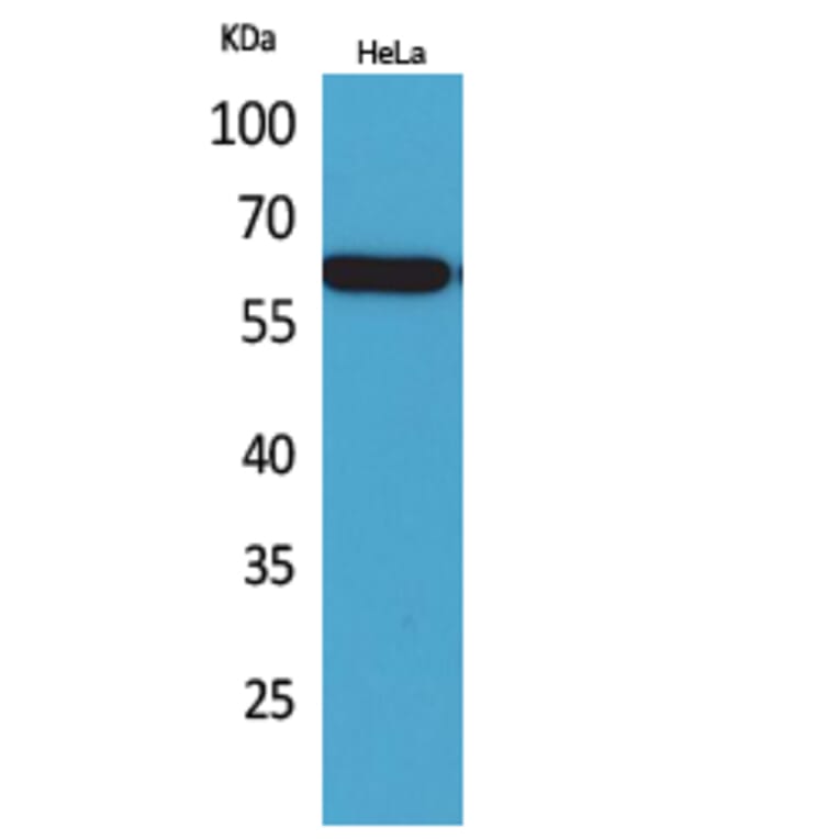 Western blot - Nectin 3 Polyclonal Antibody from Signalway Antibody (41668) - Antibodies.com