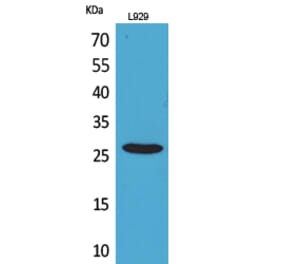 Western blot - CD159a/c Polyclonal Antibody from Signalway Antibody (41694) - Antibodies.com