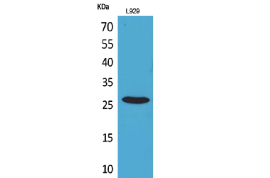 Western blot - CD159a/c Polyclonal Antibody from Signalway Antibody (41694) - Antibodies.com