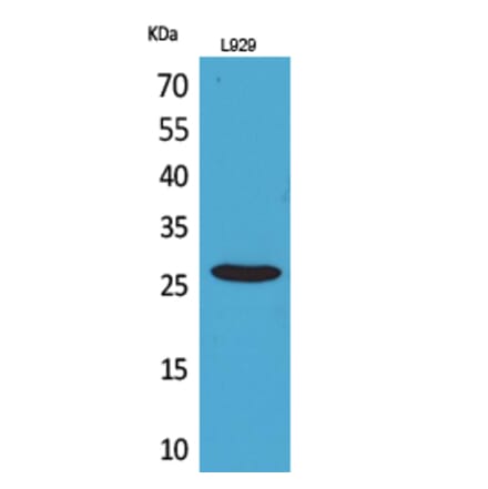 Western blot - CD159a/c Polyclonal Antibody from Signalway Antibody (41694) - Antibodies.com