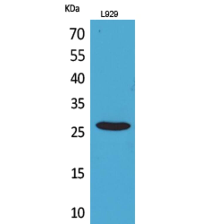Western blot - CD159a/c Polyclonal Antibody from Signalway Antibody (41694) - Antibodies.com
