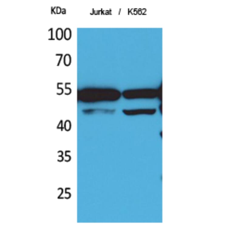 Western blot - HNF-4α/γ Polyclonal Antibody from Signalway Antibody (41720) - Antibodies.com