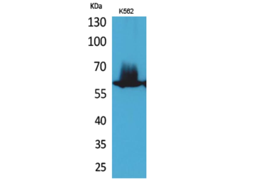 Western blot - NFκB-p65 Polyclonal Antibody from Signalway Antibody (41732) - Antibodies.com