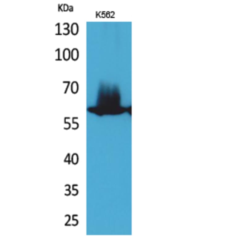 Western blot - NFκB-p65 Polyclonal Antibody from Signalway Antibody (41732) - Antibodies.com