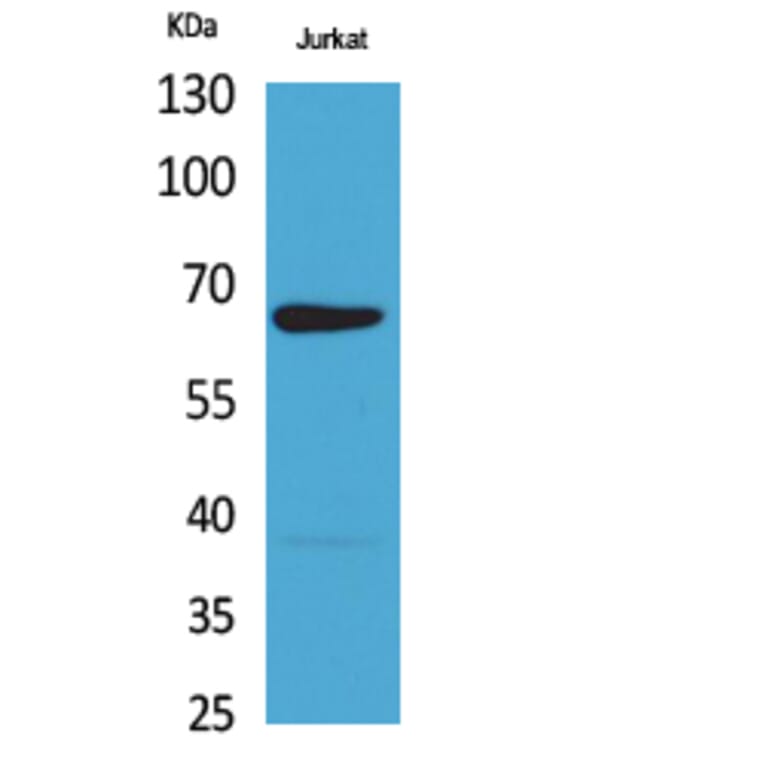Western blot - NFκB-p65 Polyclonal Antibody from Signalway Antibody (41733) - Antibodies.com