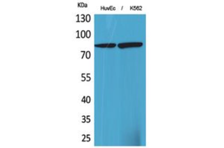 Western blot - 17β-HSD4 Polyclonal Antibody from Signalway Antibody (41772) - Antibodies.com
