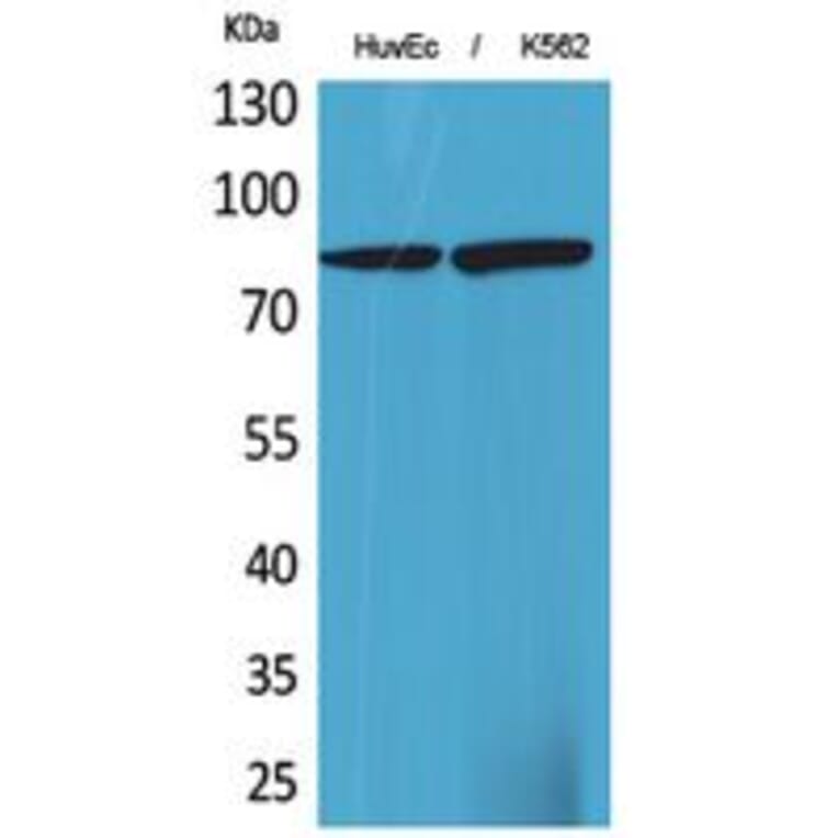 Western blot - 17β-HSD4 Polyclonal Antibody from Signalway Antibody (41772) - Antibodies.com