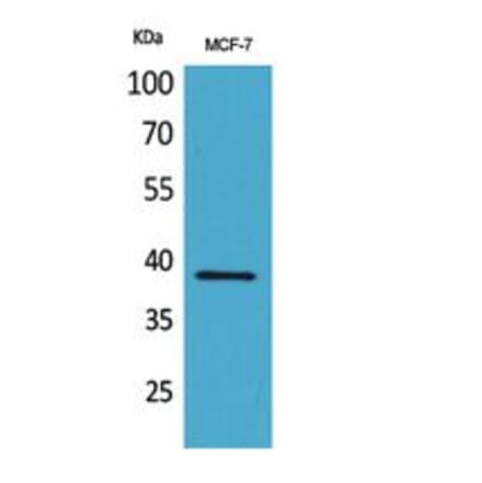 Western blot - Cerberus Polyclonal Antibody from Signalway Antibody (41795) - Antibodies.com