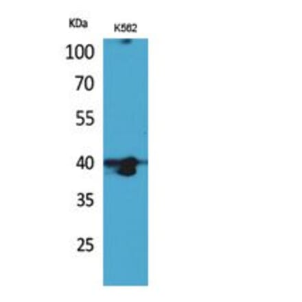 Western blot - GPR87/95 Polyclonal Antibody from Signalway Antibody (41816) - Antibodies.com